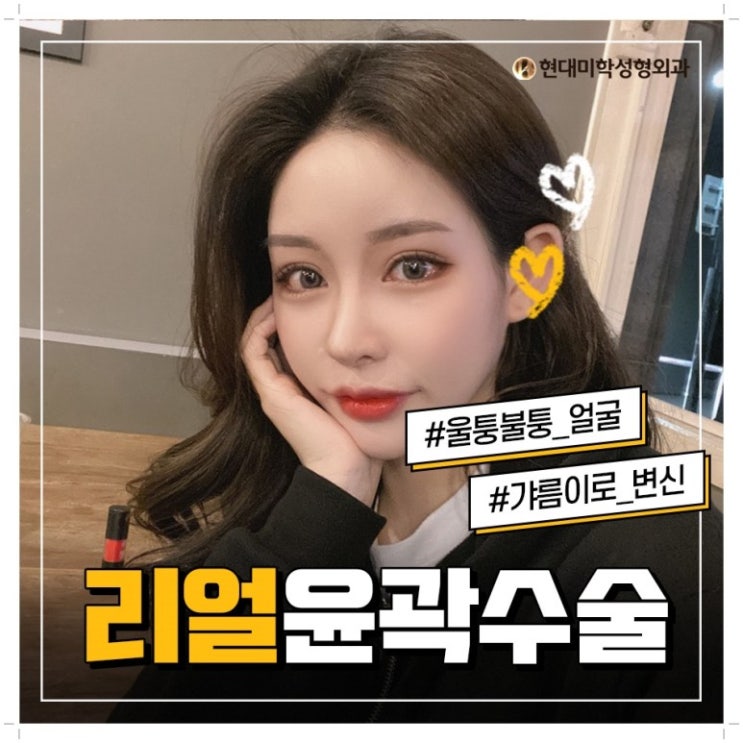ศัลยกรรมลดโหนกแก้มที่มองแวบเดียวก็รู้ว่าสวยขึ้น