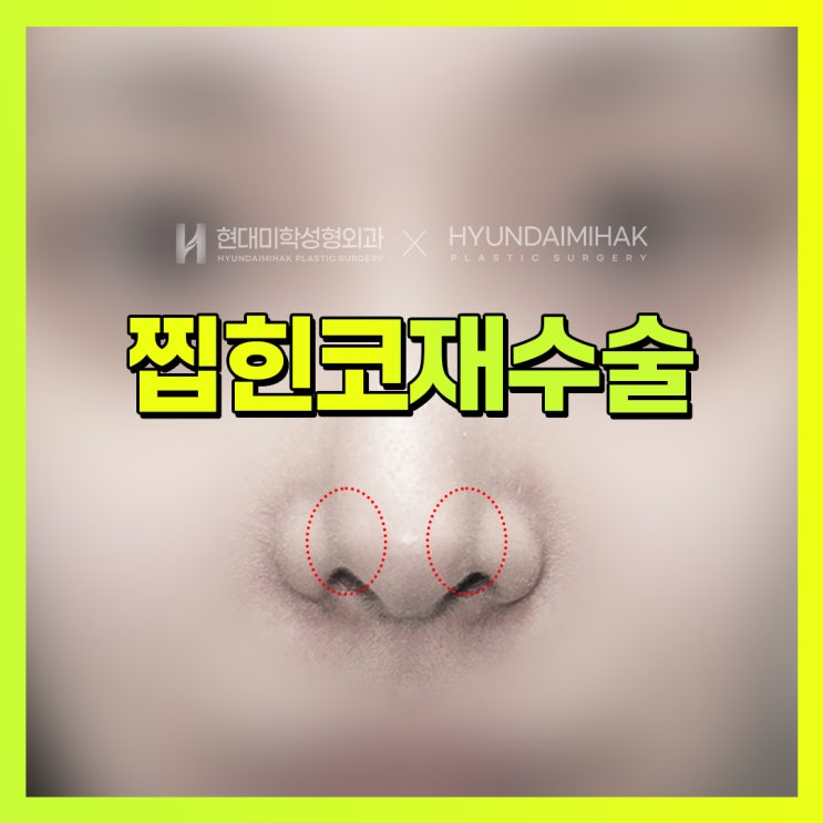 การผ่าตัดแก้จมูกที่ดูถูกบีบ ควรดำเนินการอย่างไร?