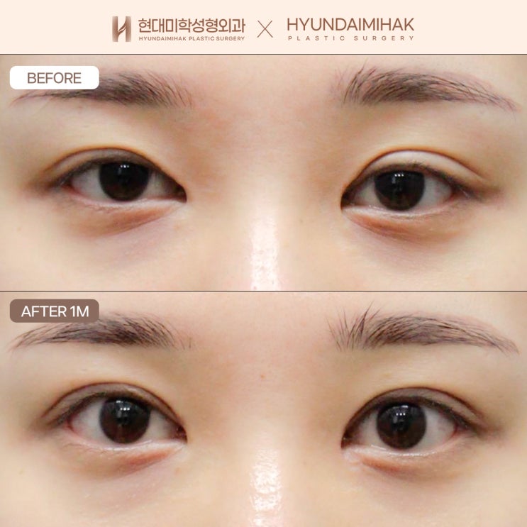 หากคุณกำลังมองหาคลินิกที่เชี่ยวชาญด้านการแก้ตา