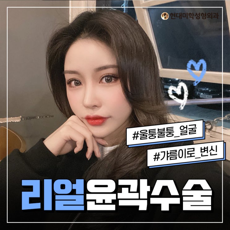 ตรวจสอบค่าใช้จ่ายศัลยกรรมโหนกแก้มได้ตอนนี้