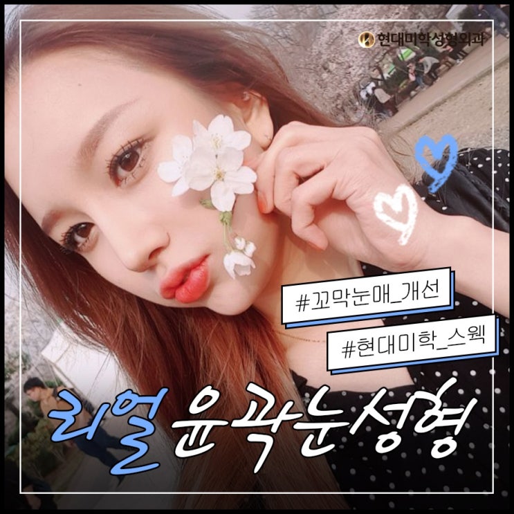 ราคาศัลยกรรมแก้ตาสองชั้น เติมเต็มความสวยอีกครั้ง