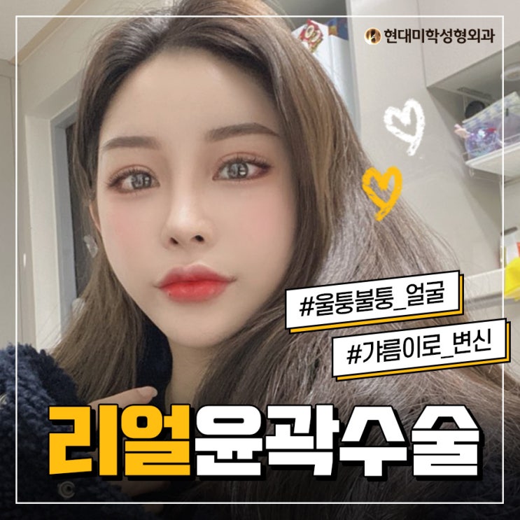 ราคาศัลยกรรมปรับโครงหน้า คุ้มค่ากับความสวยที่เปล่งประกาย