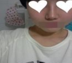 ฉันทำจมูกมาแล้ว~~~