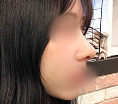 หน้าดูมีมิติมากขึ้นแล้วค่ะ ฮ่าๆ