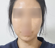 เส้นหน้าดูเรียบร้อยขึ้น -