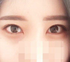ทำเปิดหางตาและเปิดตาล่างแล้ว!!!!