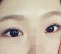 ตอนนี้ถึงรู้แล้วว่าทำไมถึงบอกว่าที่นี่ดังเรื่องผ่าตัดตา!