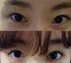 ฉันคือสาวตา 10 โมง 10 นาที