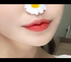 ทำศัลยกรรมมุมปากค่ะ♡
