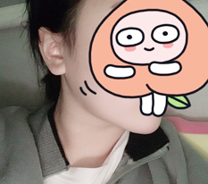 เหนียงหายไปด้วยการดูดไขมันหน้า