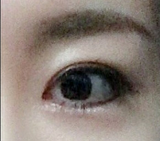 แก้ตาสำเร็จสุด ๆ ^^