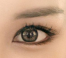 ผ่าหางตา + ผ่าใต้ตา พอใจมากๆ เลย!