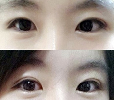 It seems it is not famous as an eye-surgery hotspot for nothing