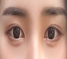 แค่ทำเส้นตาแต่ทุกคนบอกว่าสวยขึ้นเยอะเลย lol