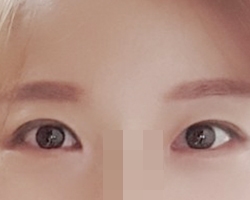 ดวงตาที่เป็นจุดเปลี่ยนสำคัญ