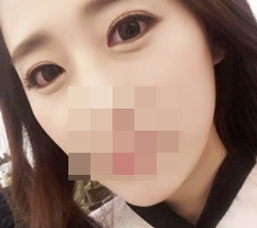Highly recommend Hyundai Thailand eye-shape correction!~♥