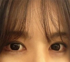 ทุกคนบอกว่าสวยขึ้นมากๆ เลยค่ะ ㅎㅎ