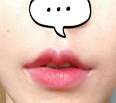 รูปปากสวยขึ้นใช่ไหมคะ? lol
