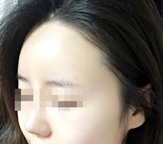 หน้าผากที่เหมือนไม่ใช่ของฉัน แต่ก็เหมือนของฉัน : )