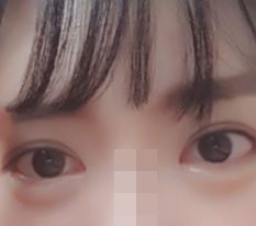 ครั้งแรกที่มีคนบอกว่าตาฉันสวย