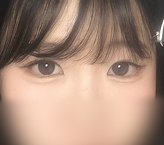 เปิดหางตาล่างแบบโล่งขึ้น