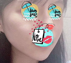 ขอให้บวมยุบไวๆ เถอะ~~~~~