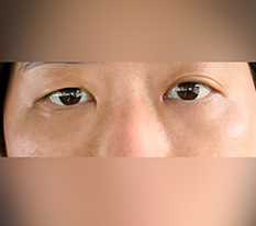 ผลลัพธ์ค่อนข้างดีครับ
