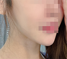 รูปหน้าดูเรียบเนียนㅎㅎ