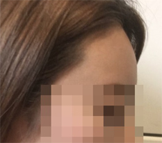 ขอบคุณหน้าผากนูนสวยที่ทำให้ใบหน้าดูมีมิติมากขึ้น~ ฮิ