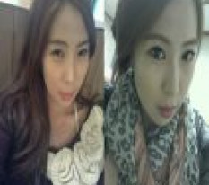 ทำผ่าตัดตาครบทุกอย่างที่ทำได้ เกิดใหม่อีกครั้ง >.<