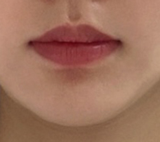 เอาชนะปมเรื่องริมฝีปากได้แล้ว.. ฮ่าๆ