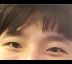 รีวิวศัลยกรรมตาค่ะ ㅋ