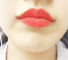 ยกมุมปาก+ยอดริมฝีปากแล้วค่ะ~♥