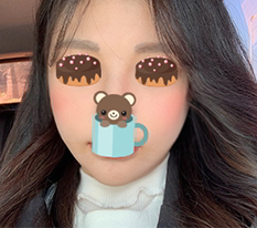 ผ่าตัดโหนกแก้มแก้ใหม่ออกมาสวยค่ะ^^