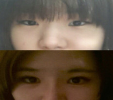 เปลี่ยนลุคสำเร็จด้วยศัลยกรรมตาและจมูก :)