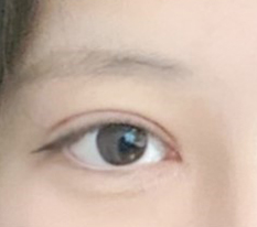 ทำตาสองชั้นแล้วเหมือนได้ชีวิตใหม่ㅠㅠ