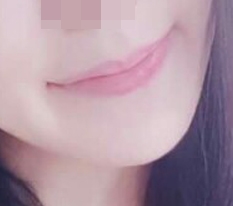 มุมปากดูเซ็กซี่ขึ้น