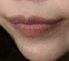 ยิ้มได้มั่นใจเพราะมุมปากค่ะ