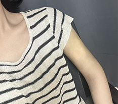 Now I can wear sleeveless tops without hesitation haha