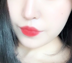 พอใจกับศัลยกรรมมุมปากมากๆๆ!!