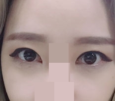 ฉันทำตาสองชั้นกับเปิดตาแบบดูอัลค่ะ!