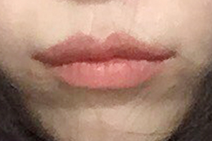 ตอนนี้เข้าใจแล้วว่าทำไมทุกคนถึงทำมุมปาก