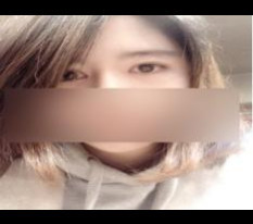 รีวิวสั้นๆ กรีดตาสองชั้น เปิดหัวตา และผ่าตัดผนังกั้นจมูก