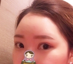Eye correction at Hyundai Thailand!!