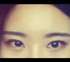 รีวิวศัลยกรรมตาค่ะ ㅎㅎㅎ