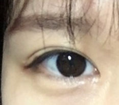 เพราะคุณหมอ ดวงตาของฉันเลยสวยขึ้นค่ะ