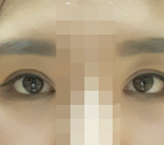 ดวงตาเปลี่ยนไปจนจำแทบไม่ได้