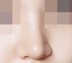 จมูกฉันสวยไหม?