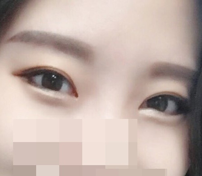 Perfect Big Eye ดีสุดๆ><b