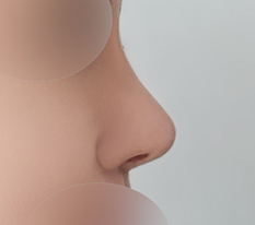 My nose turned out well